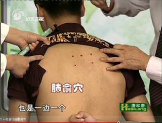 穴位养生之治疗感冒的穴位（视频）