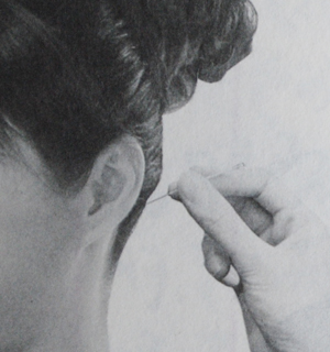 膝痛的病因和症状及风府穴治膝痛