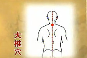 风寒感冒|找大椎穴 立竿见影防治感冒