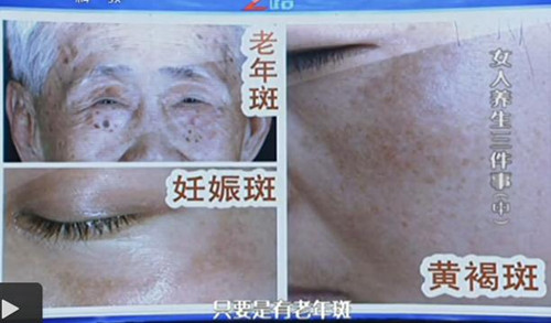 健脾养颜的穴位 补气补血的食物 疏肝清火