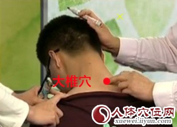 治疗落枕的穴位按摩（专家视频图解）