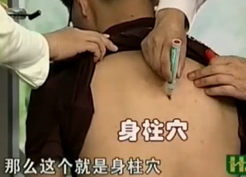 治疗咳嗽的穴位 止咳化痰效果好(视频图解)