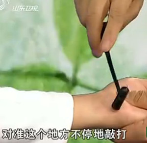 治疗心绞痛的穴位（专家视频讲解）