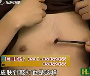 治疗心绞痛的穴位（专家视频讲解）