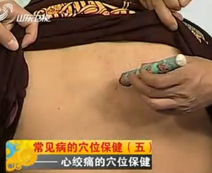 治疗心绞痛的穴位（专家视频讲解）