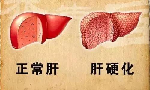 神奇的 “ 抬脚功 ”，抬的越久，身体越好，也越长寿